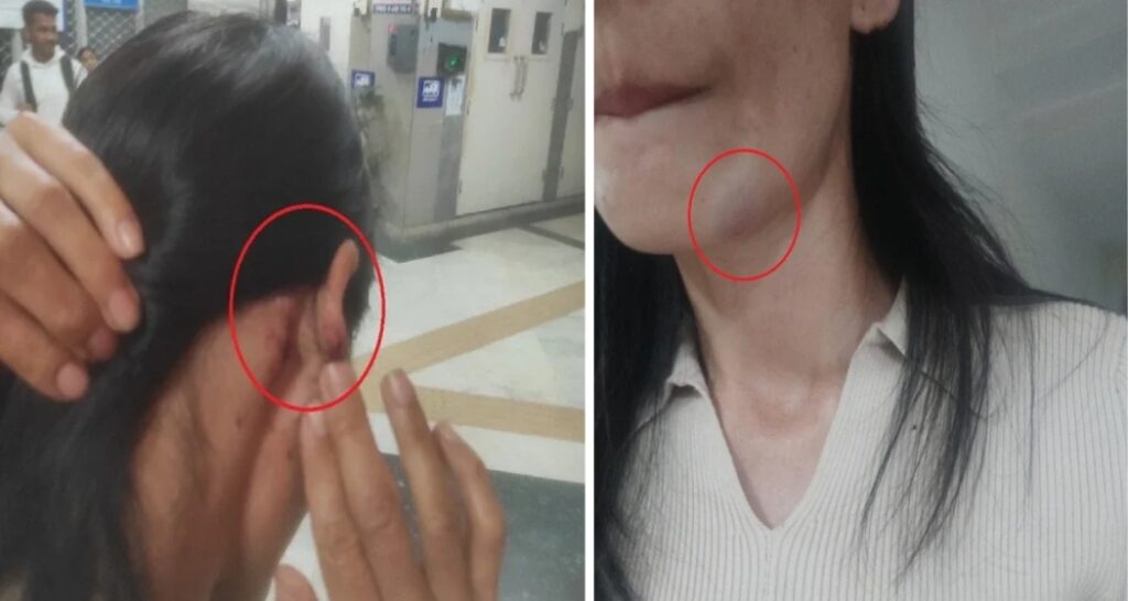 Manipur girl, Assam pal careworn, assaulted in Delhi, 2 held Manipur woman, Assam friend harassed, assaulted in Delhi, 2 held